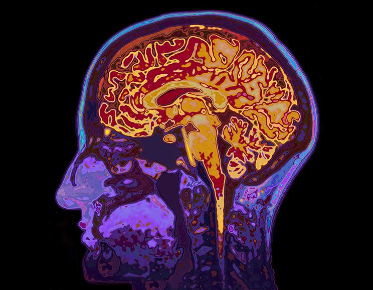 the effects of exercise on your brain featured image