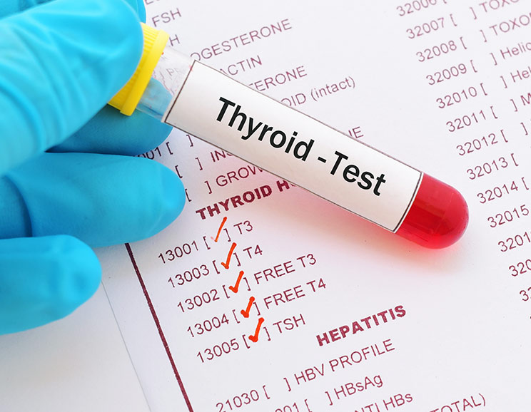 If you’re confused by the types of hormones that show up on your thyroid labs, use this guide to understand what your results mean for your health.